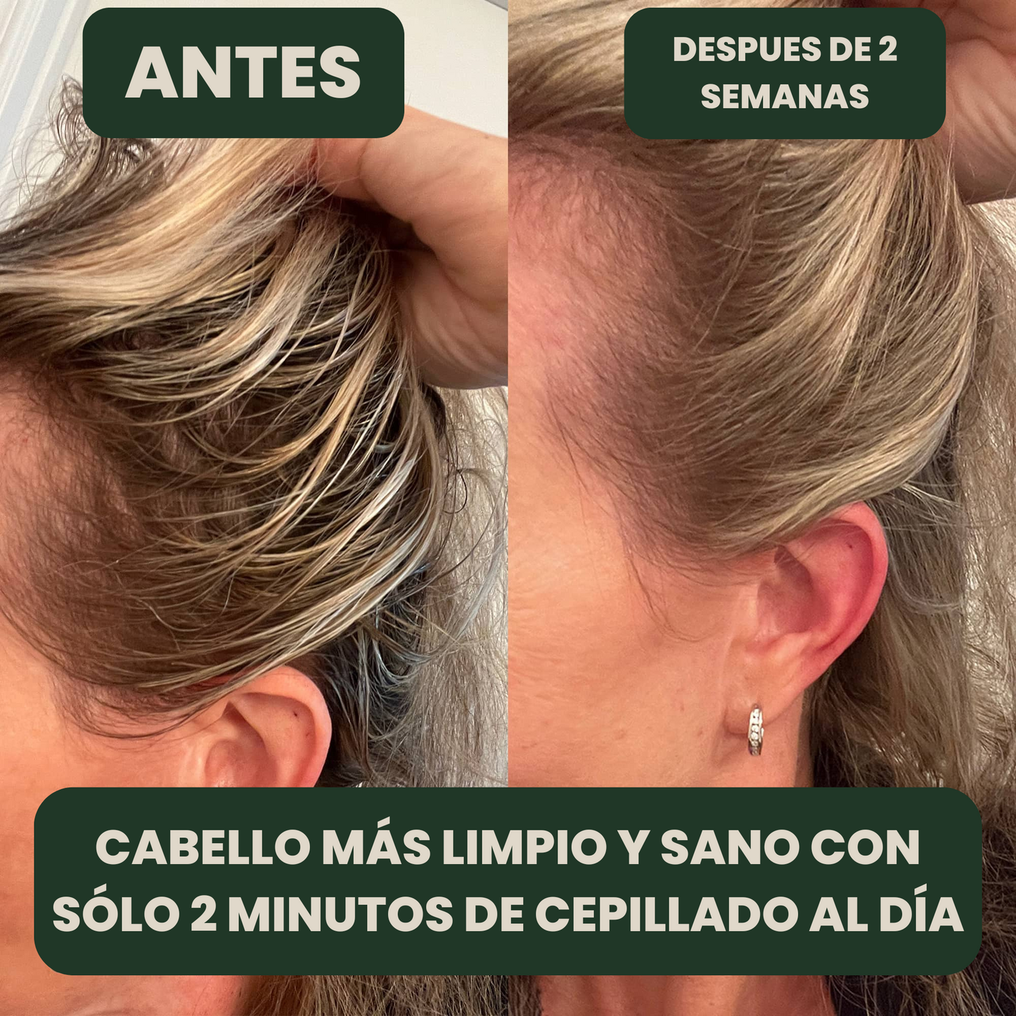 Cepillo Detox Capilar – Limpia tu cabello sin champú