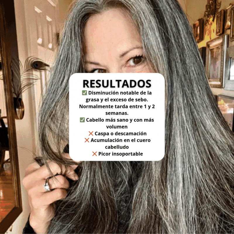Cepillo Detox Capilar – Limpia tu cabello sin champú