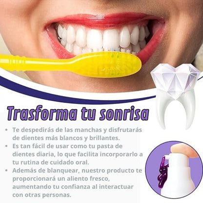 Blanqueador Dental SmileKit - La Revolución para una sonrisa radiante al Instante