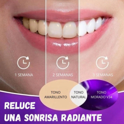 Blanqueador Dental SmileKit - La Revolución para una sonrisa radiante al Instante