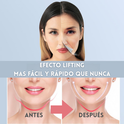 Parches de Lifting Facial Invisibles