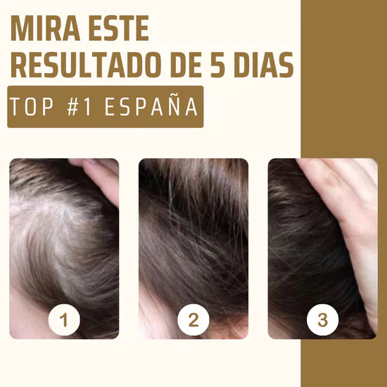 HairRevive - Crecimiento y densidad asegurada del cabello - 💥COMPRA 1 Y LLEVA 2 GRATIS💥