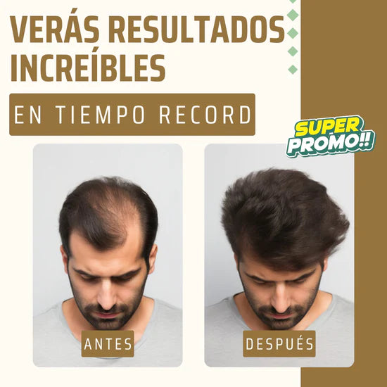 HairRevive - Crecimiento y densidad asegurada del cabello - 💥COMPRA 1 Y LLEVA 2 GRATIS💥