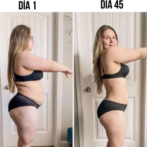 Parches GLP-1: Control del apetito y pérdida de peso natural