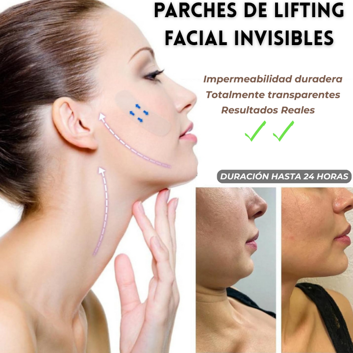 Parches de Lifting Facial Invisibles