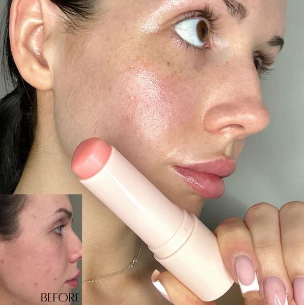 Bálsamo Hidratante Facial